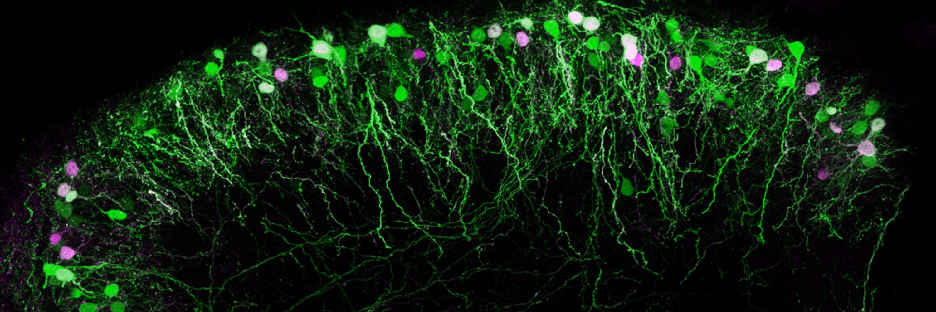 UoG Spinal Cord Group