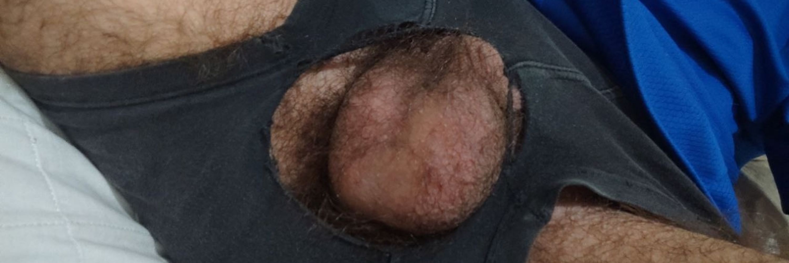 Hairy twink