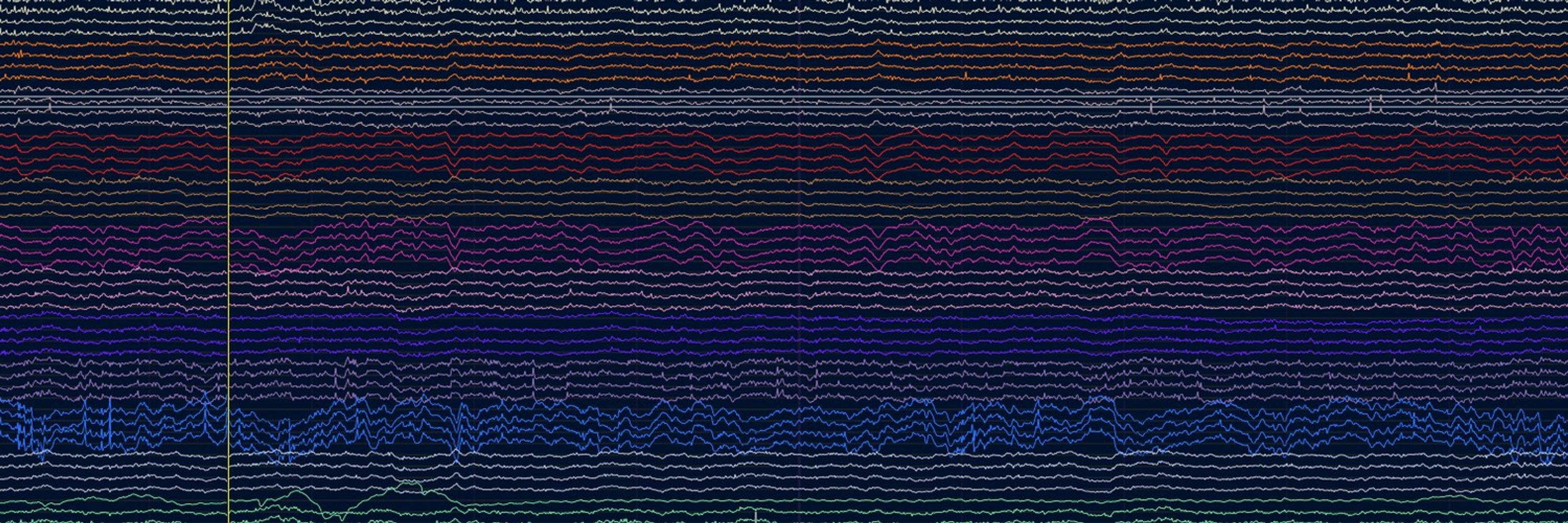 Open Ephys
