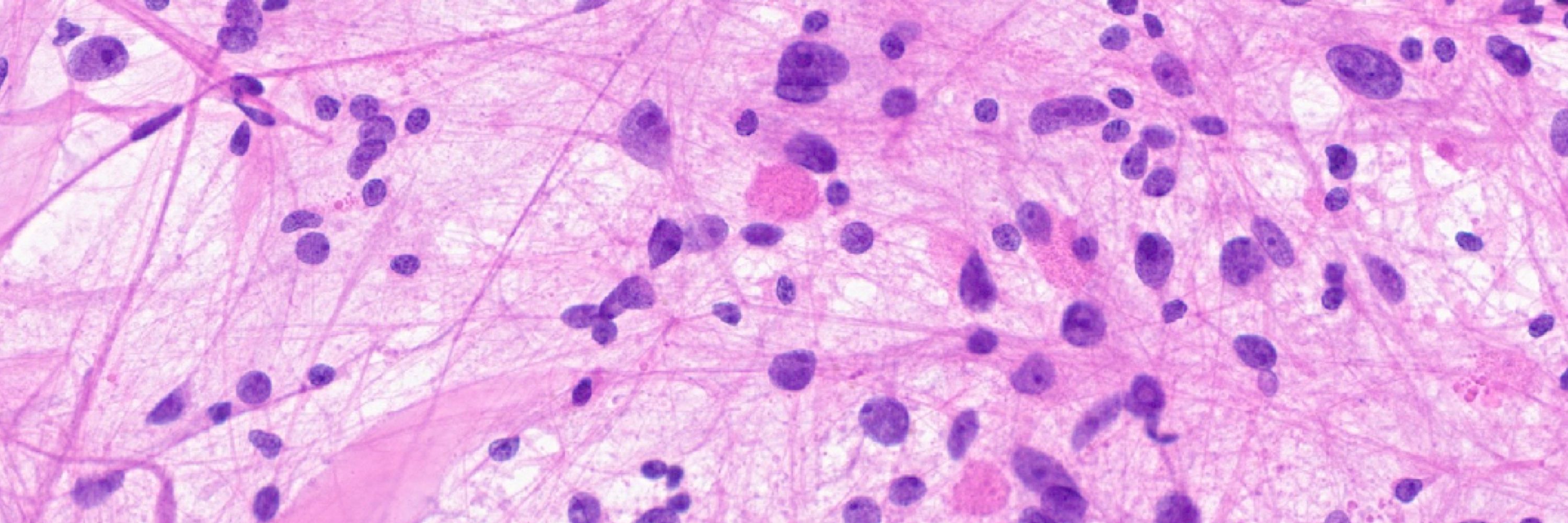Maria Gubbiotti, MD,PhD