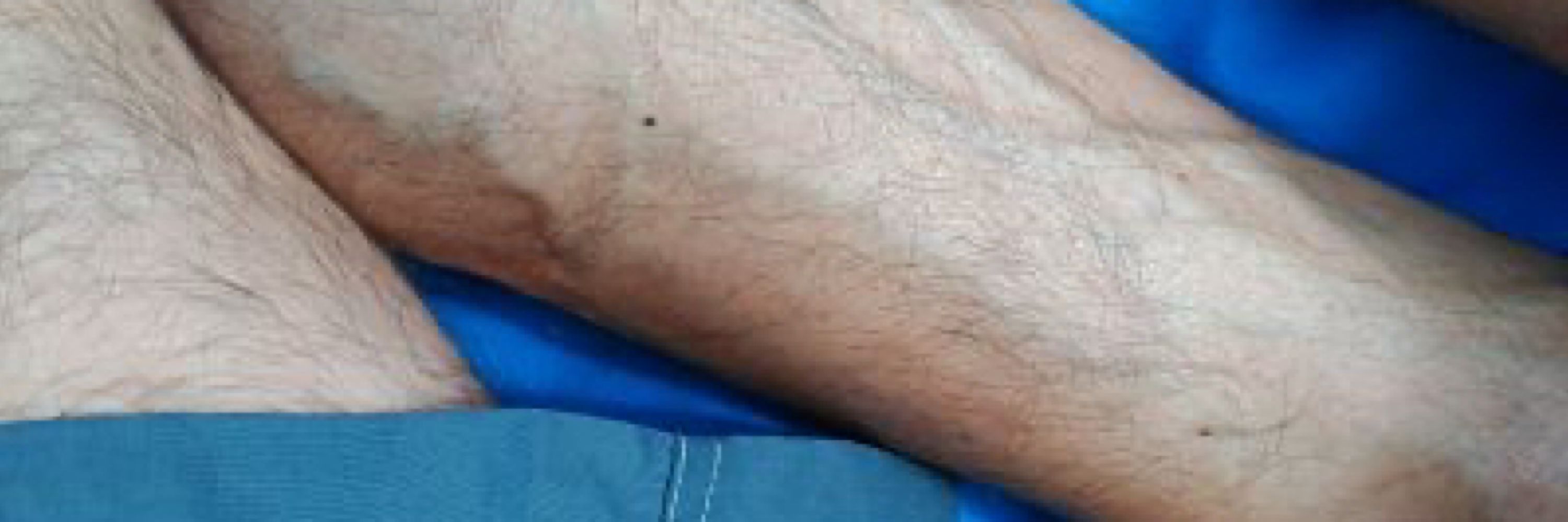 J.
