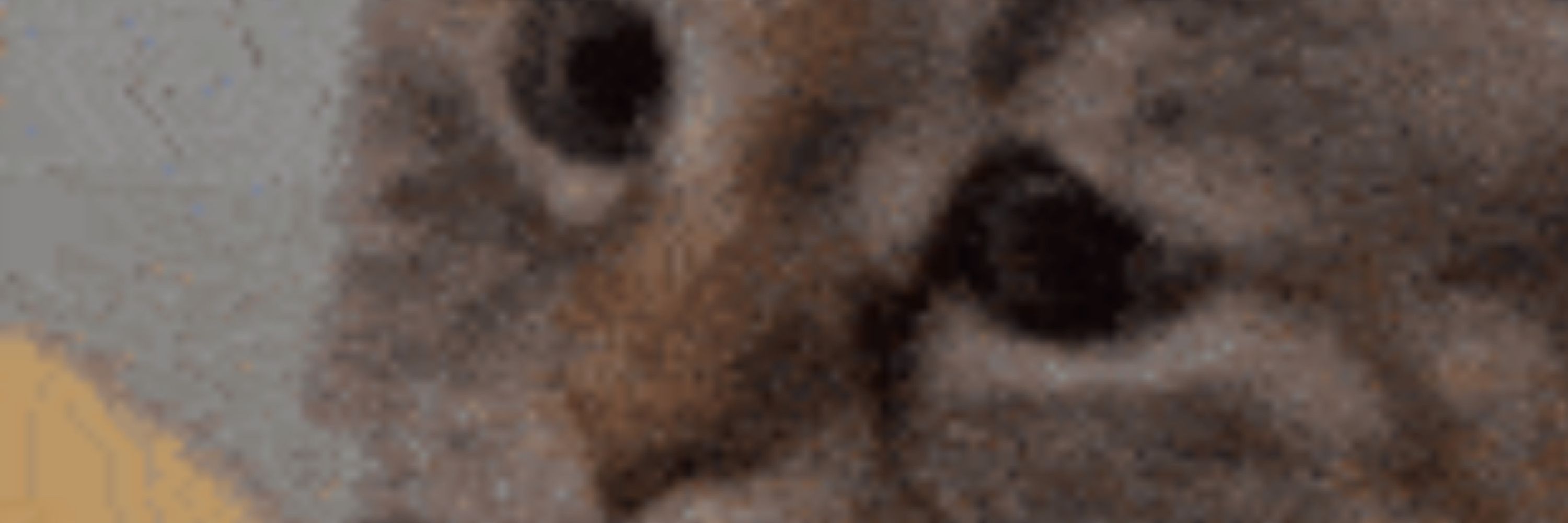 MR