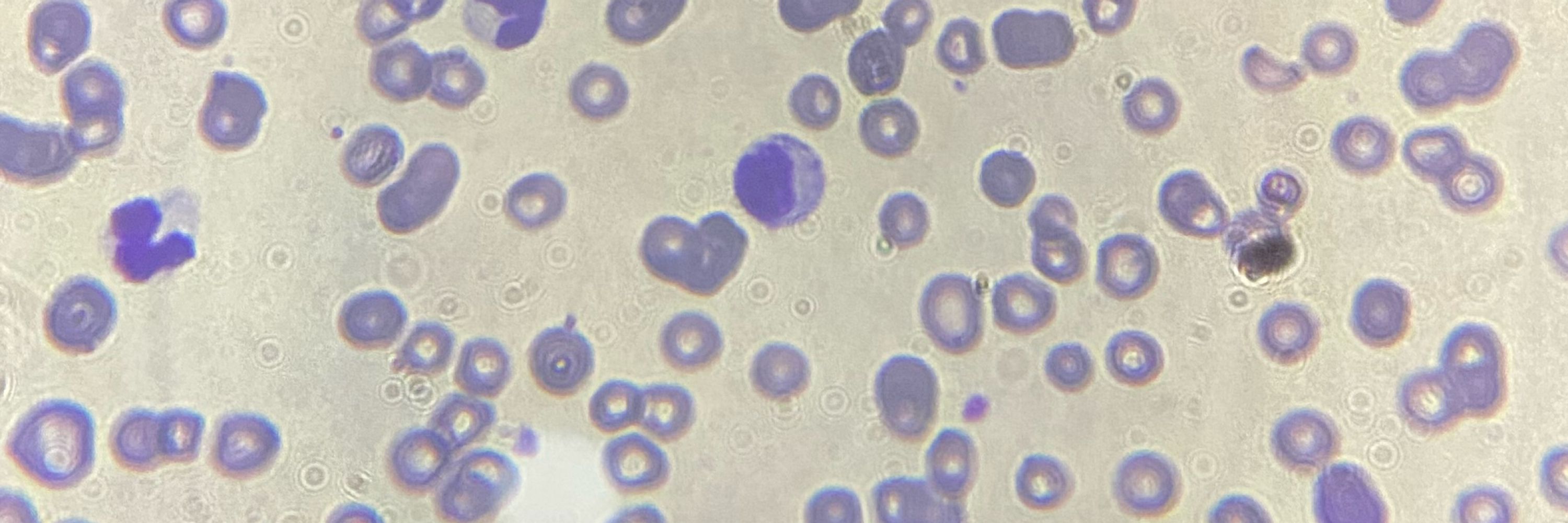 tadalafilha