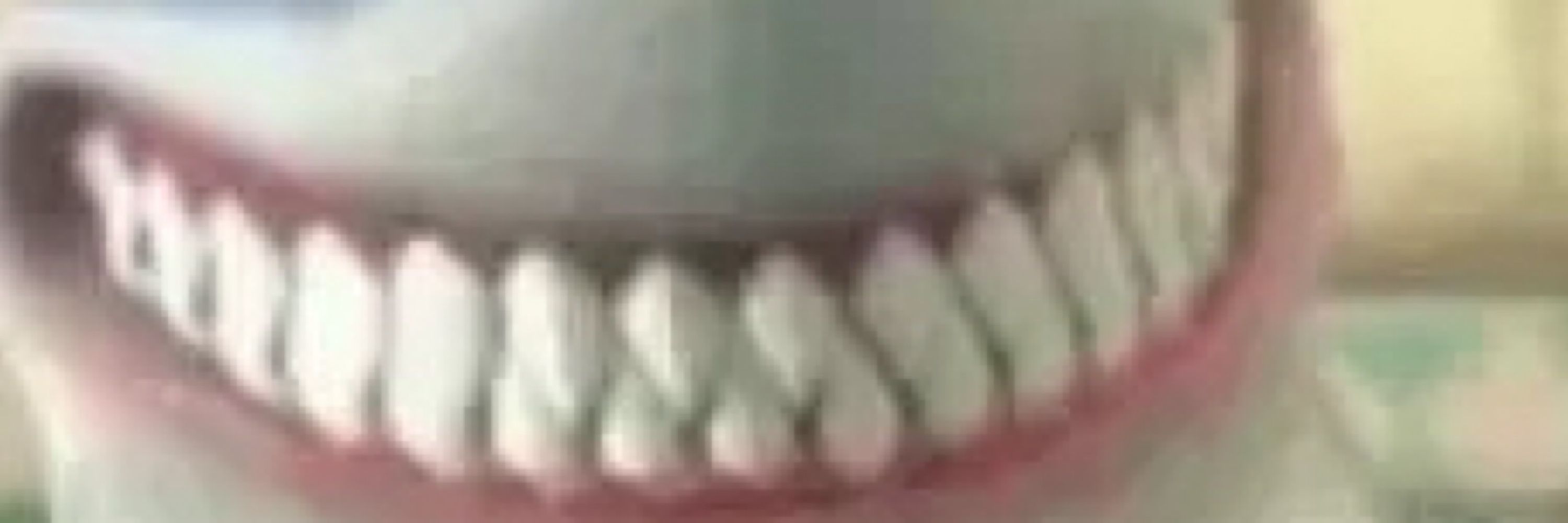 抠尼基蛙