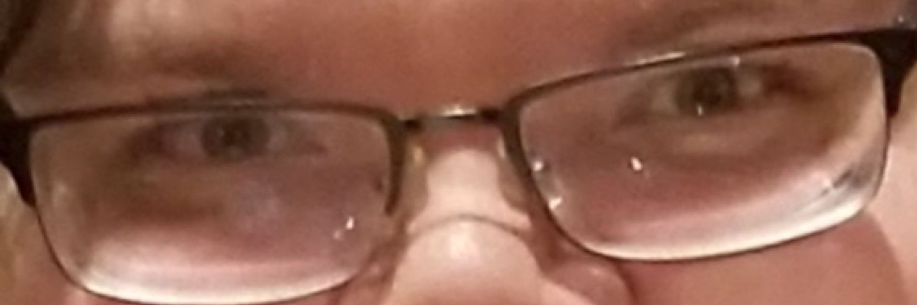 Herp