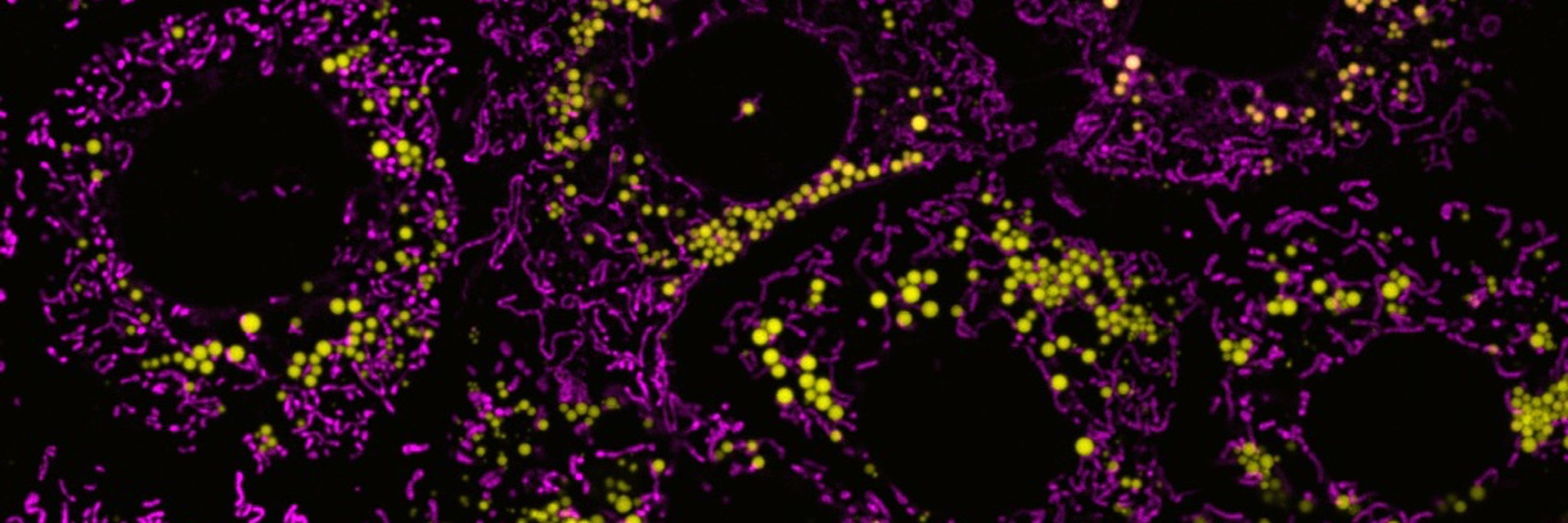 Mashek Lab