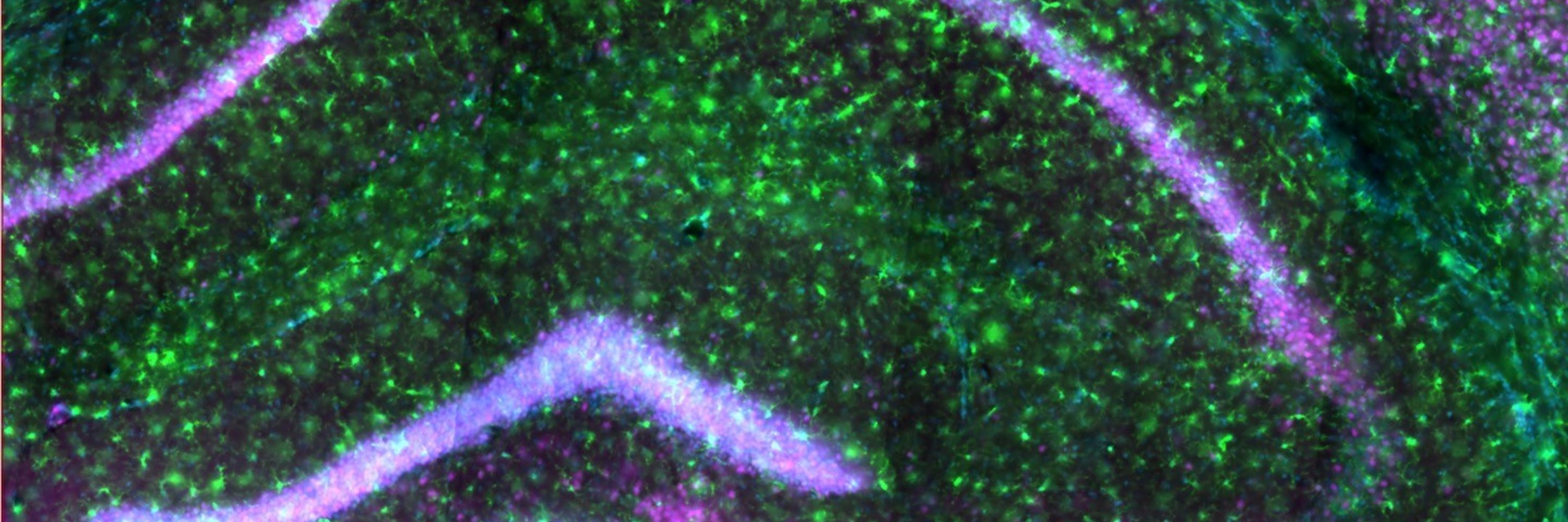 LPJ Lab - Neuroimmunometabolism