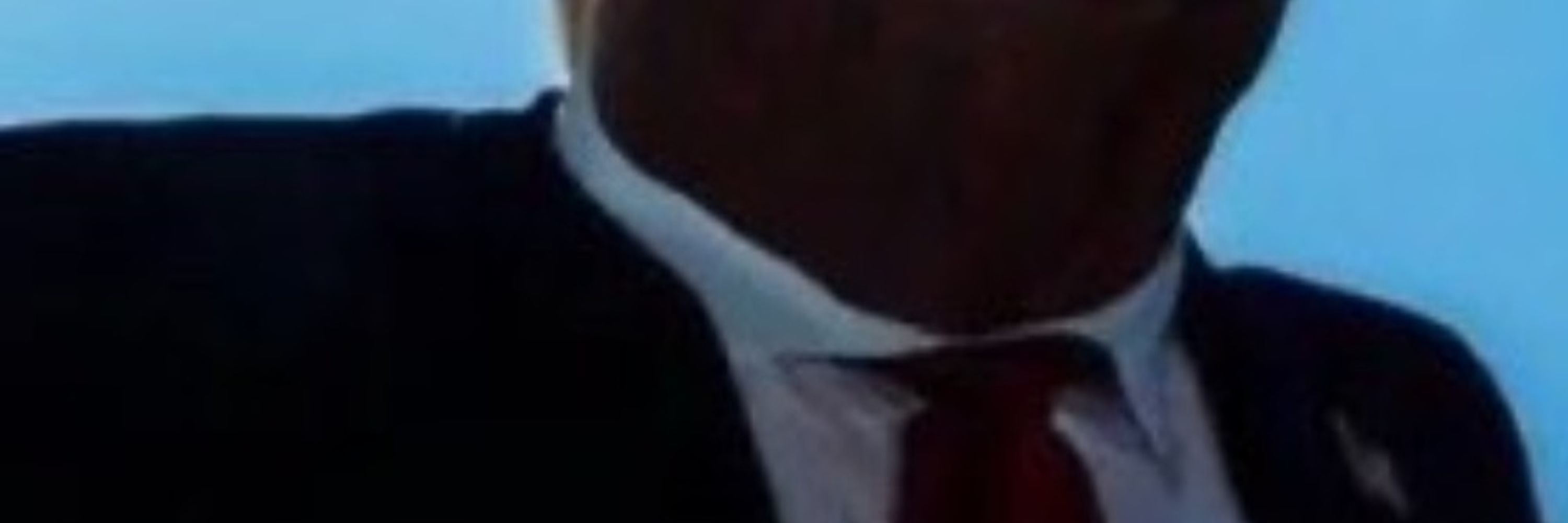 head amputee