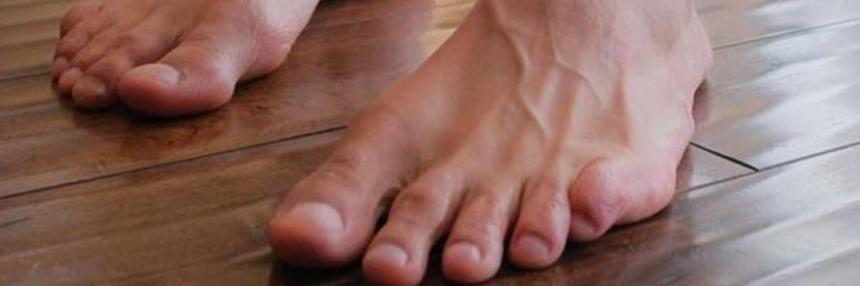 Pup Achilles