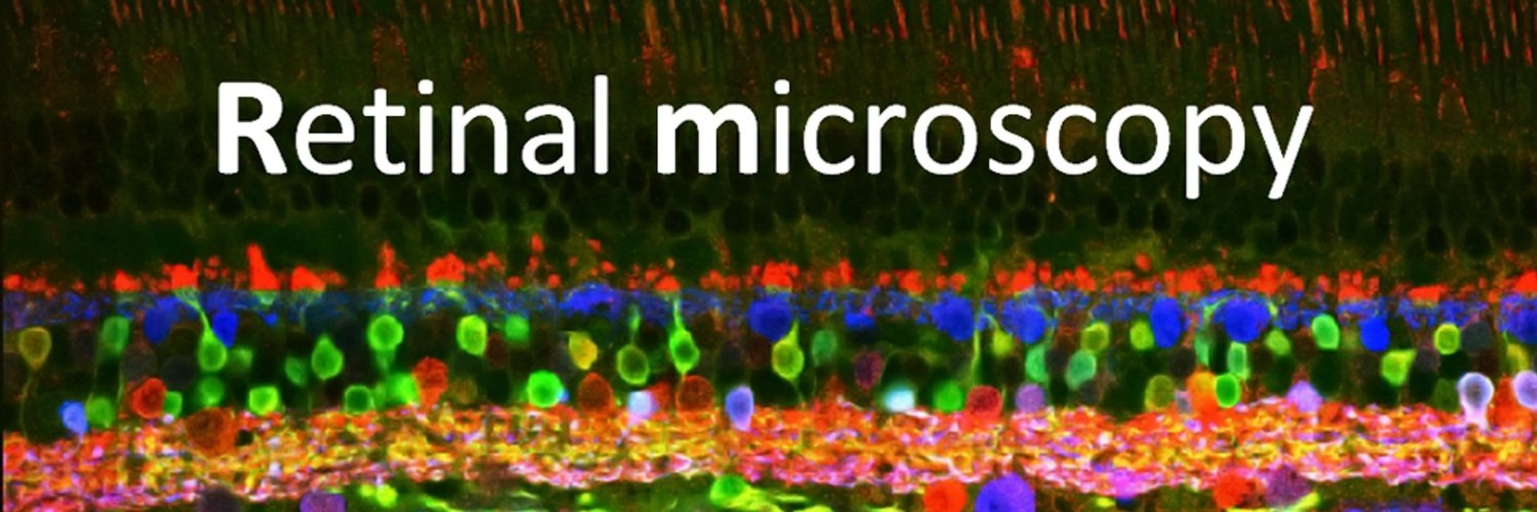 Cuenca's Lab - NEUROVIS group