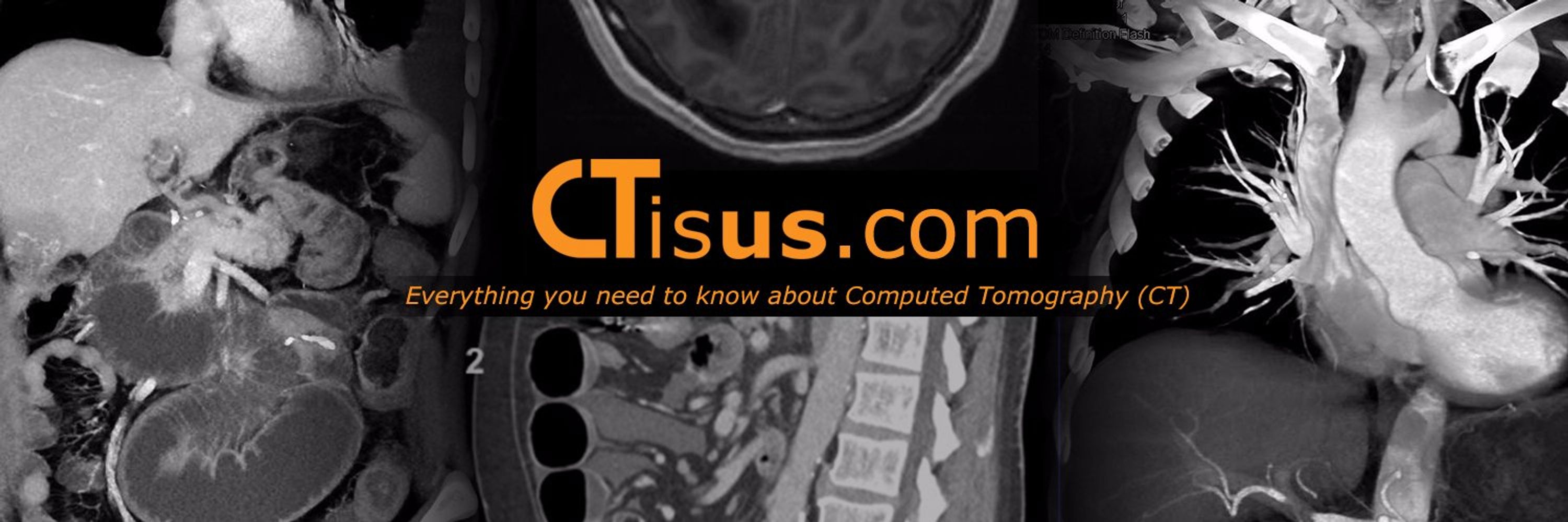 Dr Elliot K Fishman | CTisus.com