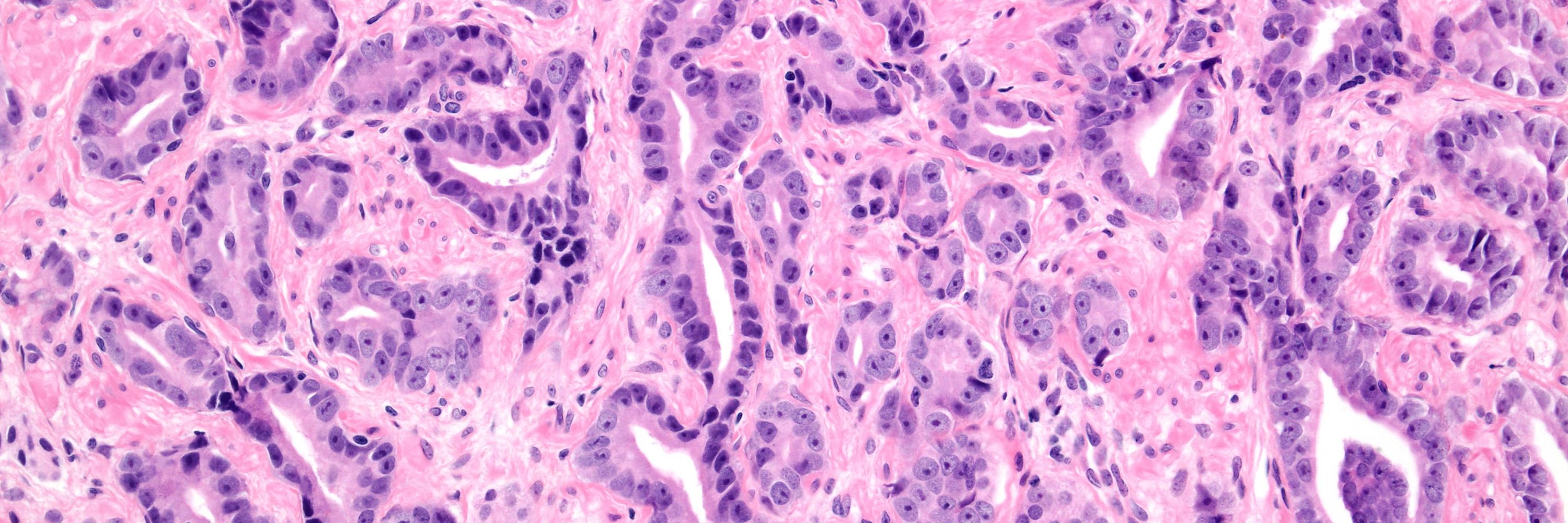 WebPathology