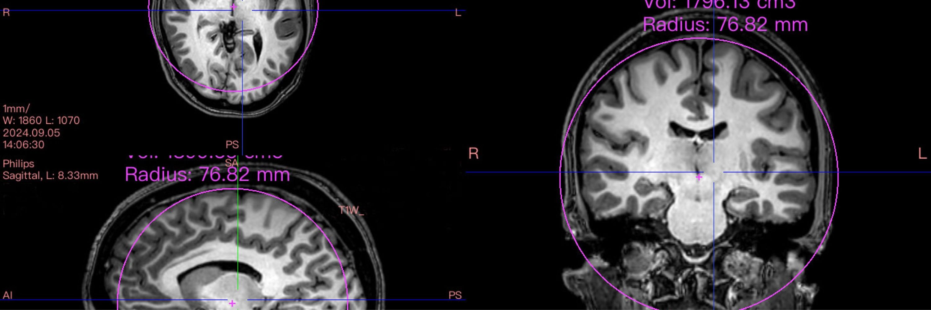 Grace — cognitive science and linguistics communication