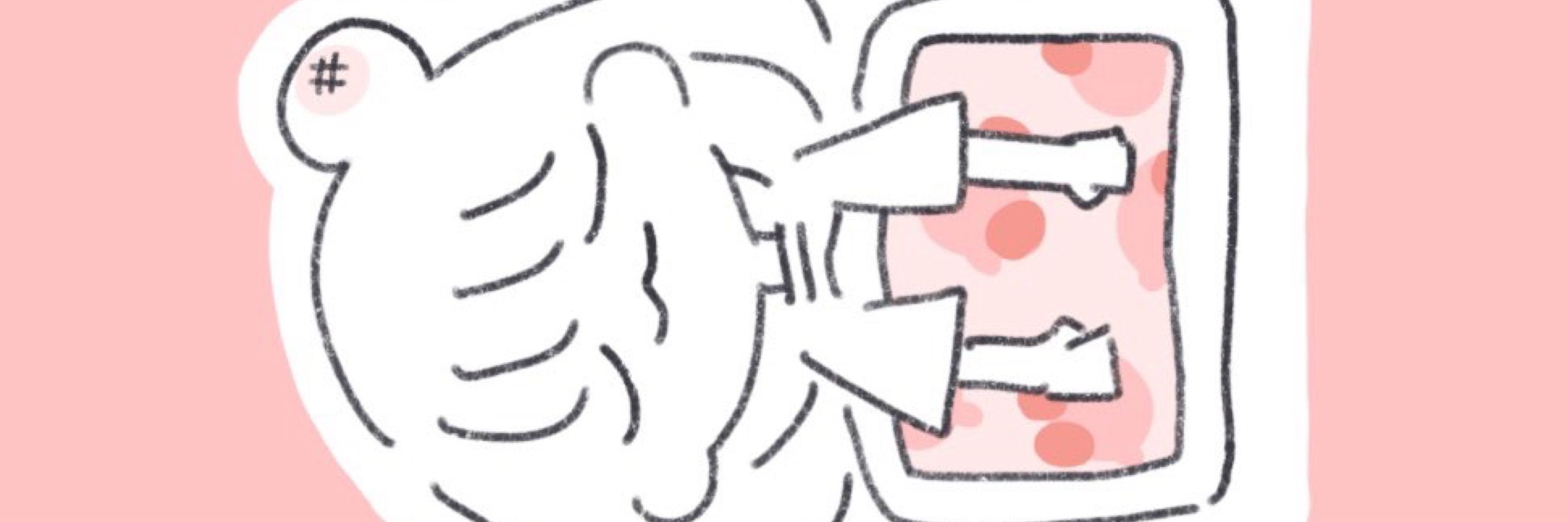 モチモチ