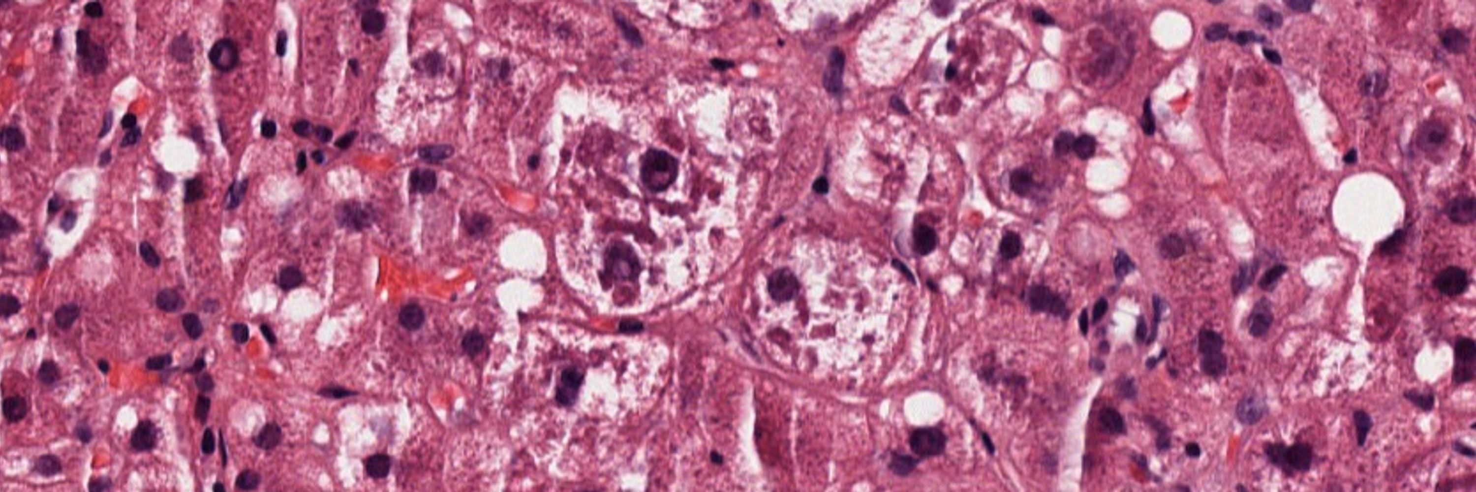 Hans Popper Hepatopathology Society