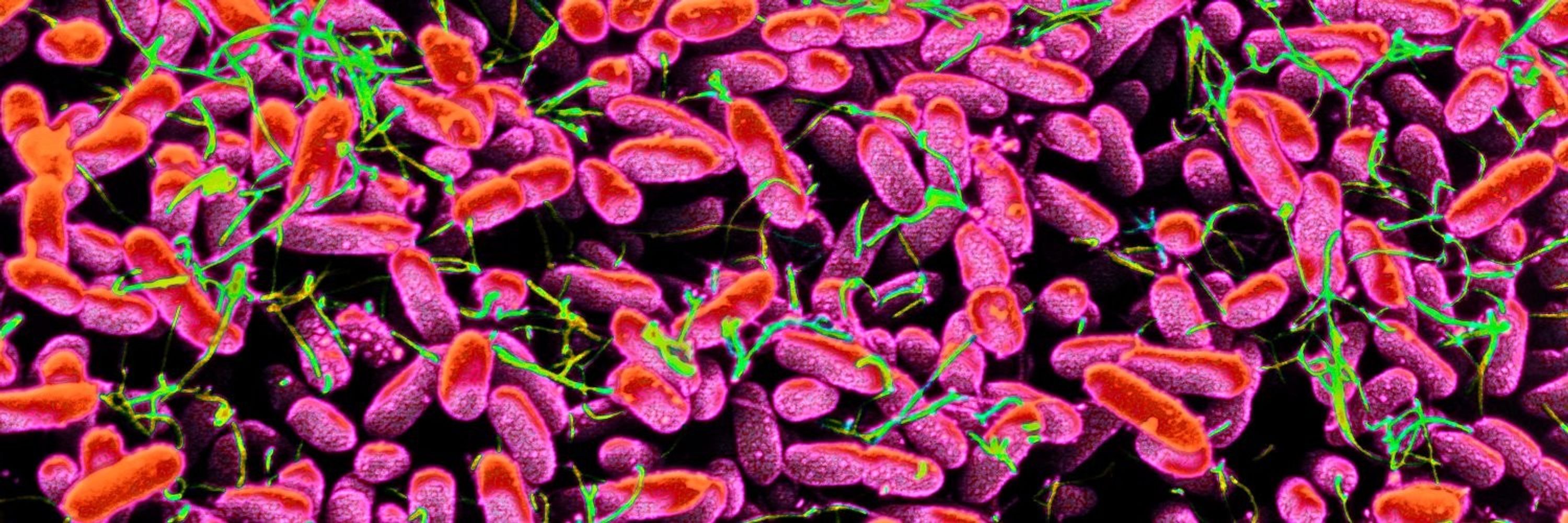 The Lancet Microbe