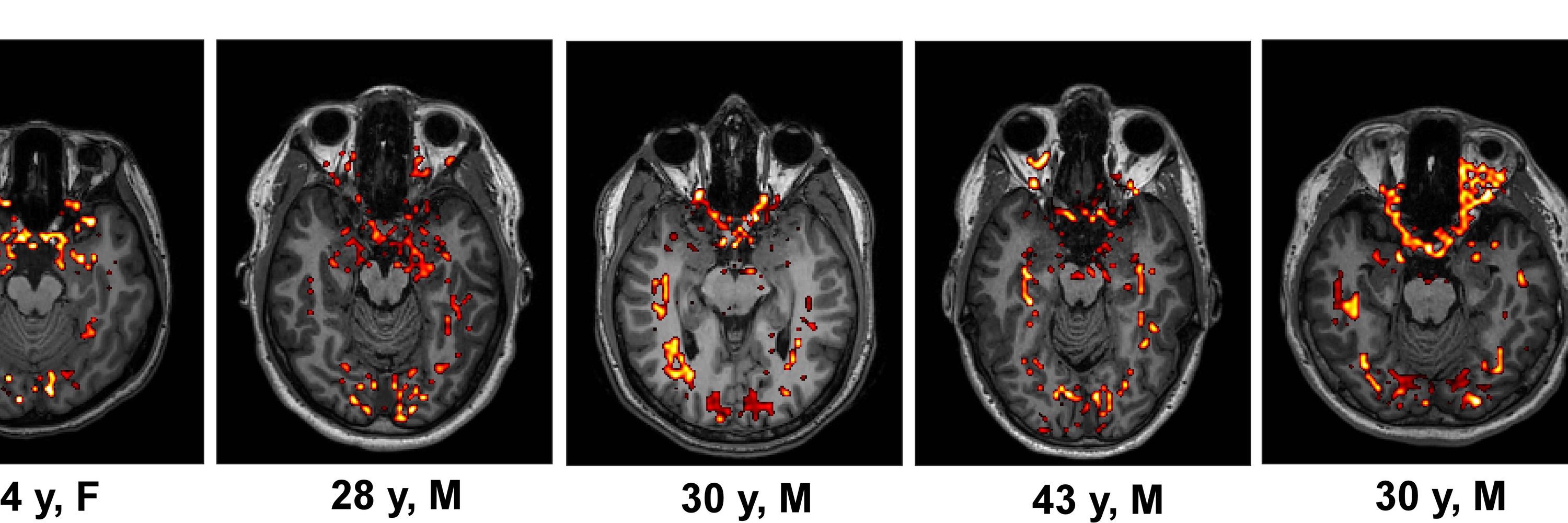 NeuRA Imaging