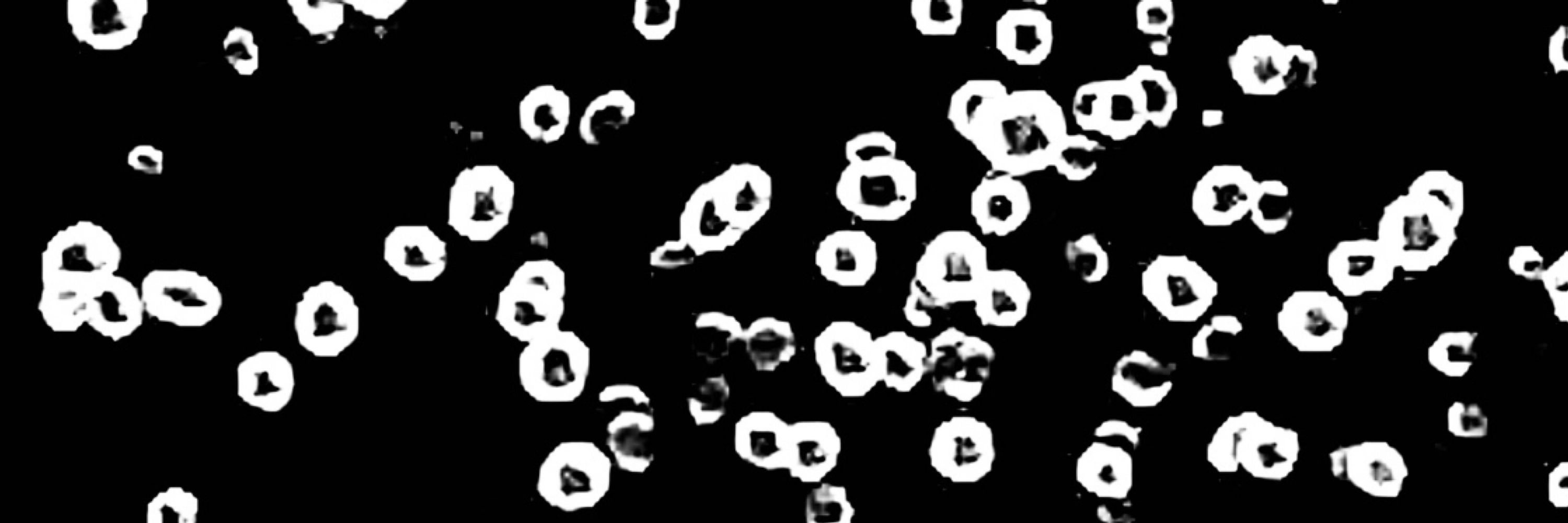 kuronoimoko