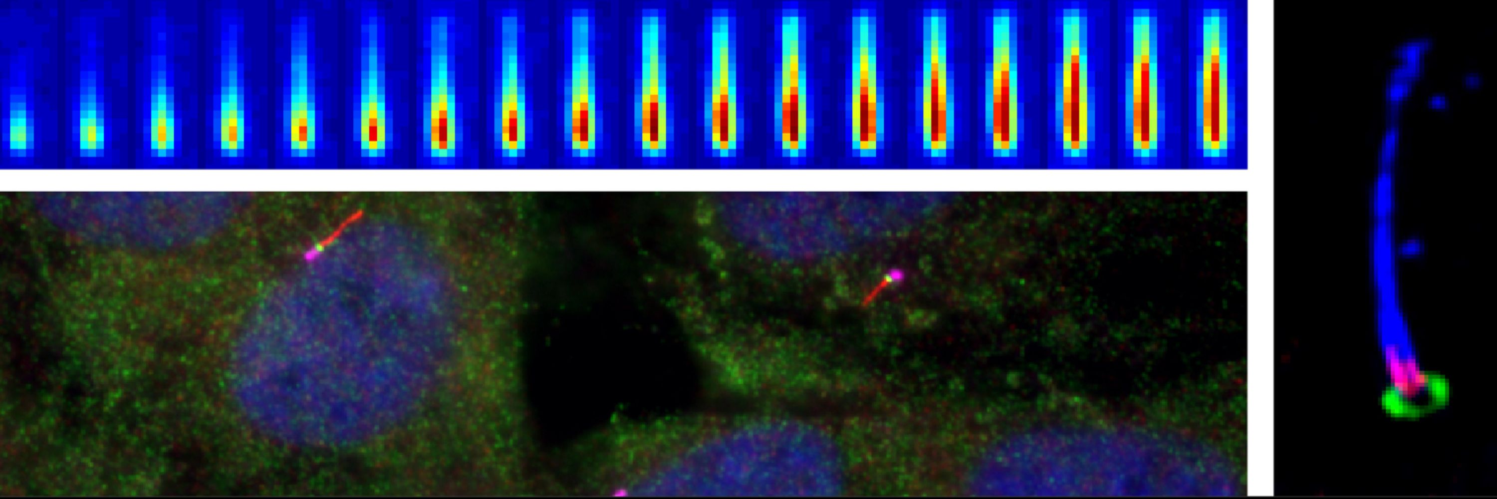 David Breslow Lab