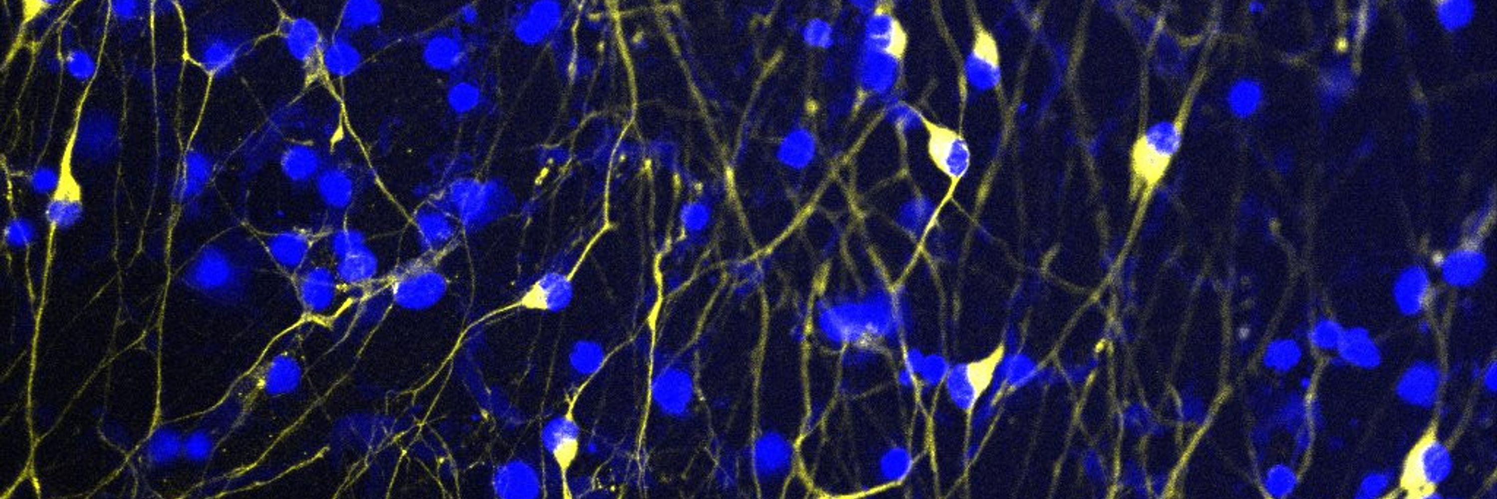 The Venkatesh Lab