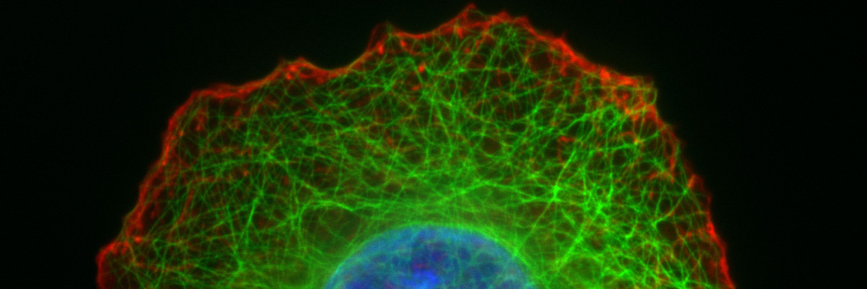 Cytoskeleton Journal