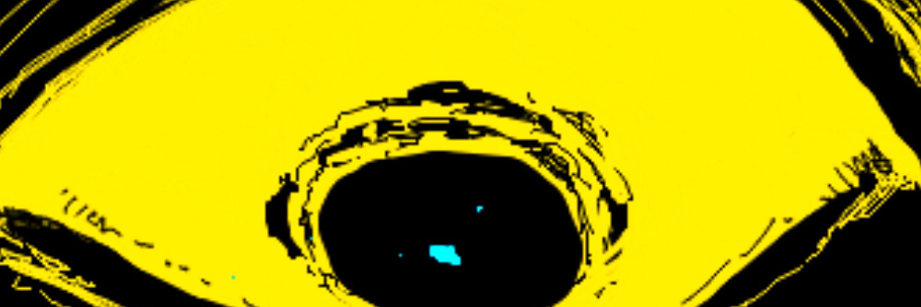 Ren