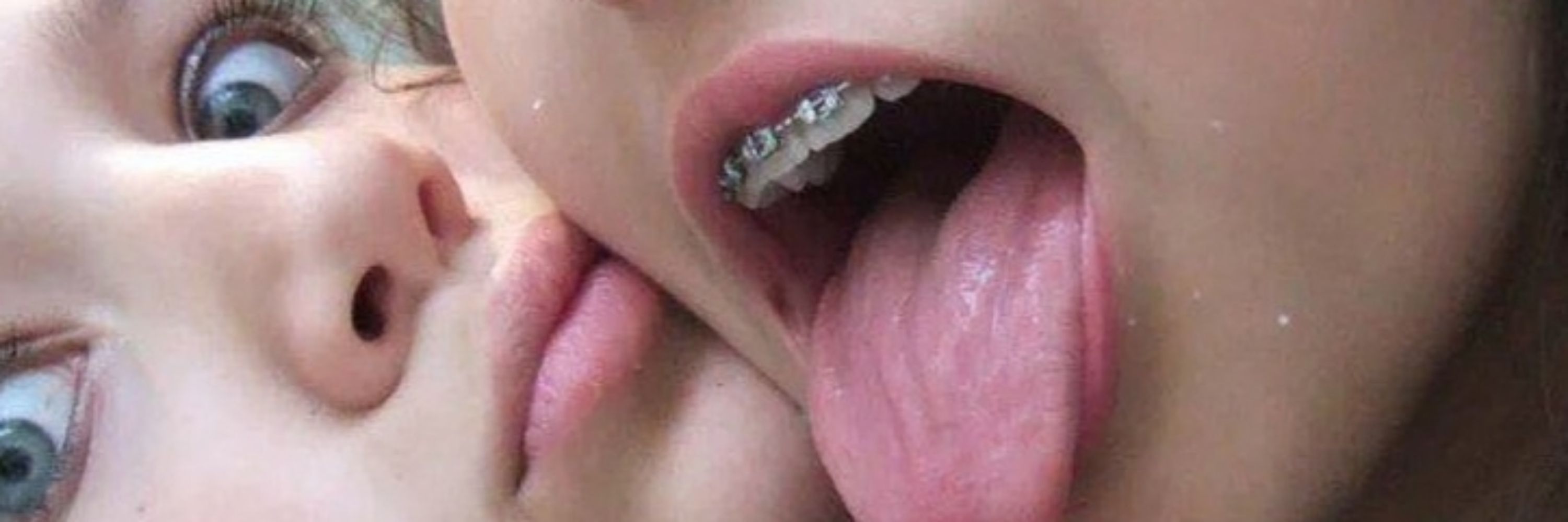 Chicks with Braces 🫶