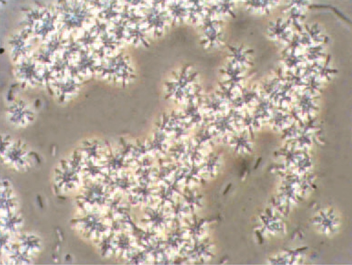 Phaeobacter inhibens "rosettes"
Fig. 2a from https://pubmed.ncbi.nlm.nih.gov/16269767/