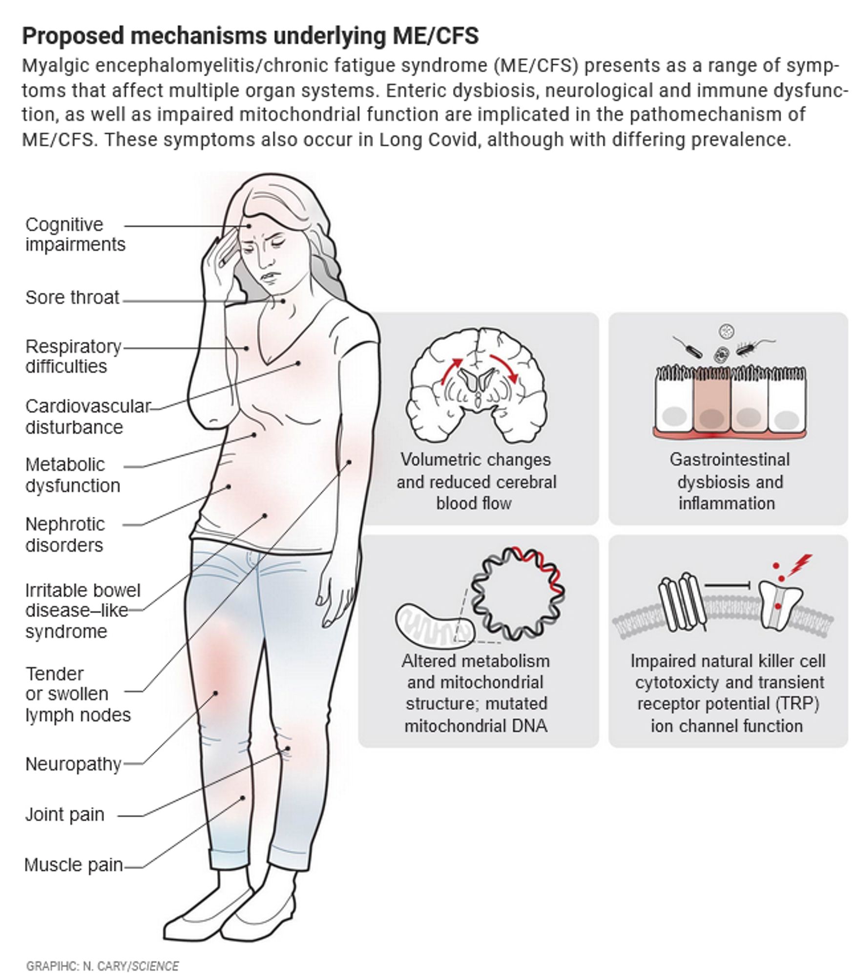 Proposed mechanisms underlying ME/CFS.
Myalgic encephalomyelitis/chronic fatigue syndrome (ME/CFS) presents as a range of symptoms that affect multiple organ systems. Enteric dysbiosis, neurological and immune dysfunction, as well as impaired mitochondrial function are implicated in the pathomechanism of ME/CFS. These symptoms also occur in Long Covid, although with differing prevalence.

Drawing of human, symptoms listed:
Cognitive impairments
Sore throat
Respiratory difficulties
Cardiovascular disturbance
Nephrotic disorders
Neuropathy
Tender or swollen lymph nodes
Metabolic dysfunction
Irritable bowel disease–like syndrome
Joint pain
Muscle pain

Four drawings in squares with texts:
1 Volumetric changes and reduced cerebral blood flow
2 Gastrointestinal dysbiosis and inflammation
3 Altered metabolism and mitochondrial structure; mutated mitochondrial DNA
4 Impaired natural killer cell cytotoxicty and transient receptor potential (TRP) ion channel function

Graphic: N. Cary/Science