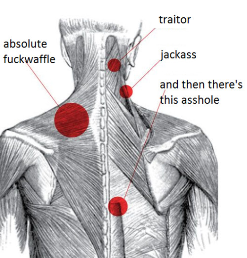 engraving of a human back and neck, with muscle fibers, several spots picked out in red and labeled “traitor,” “jackass,” “absolute fuckwaffle,” “and then there’s this asshole”