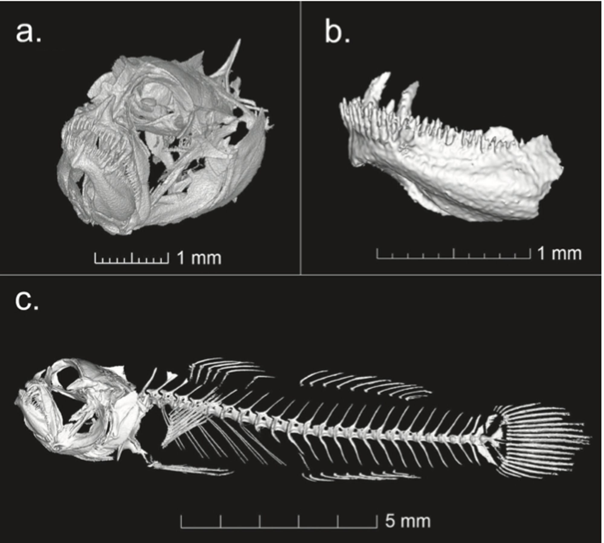 CT scans of the bone structure