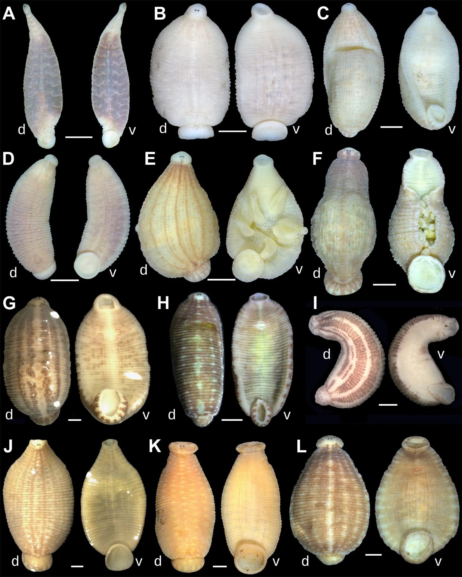 An assortment of leeches found dwelling inside of freshwater mussels