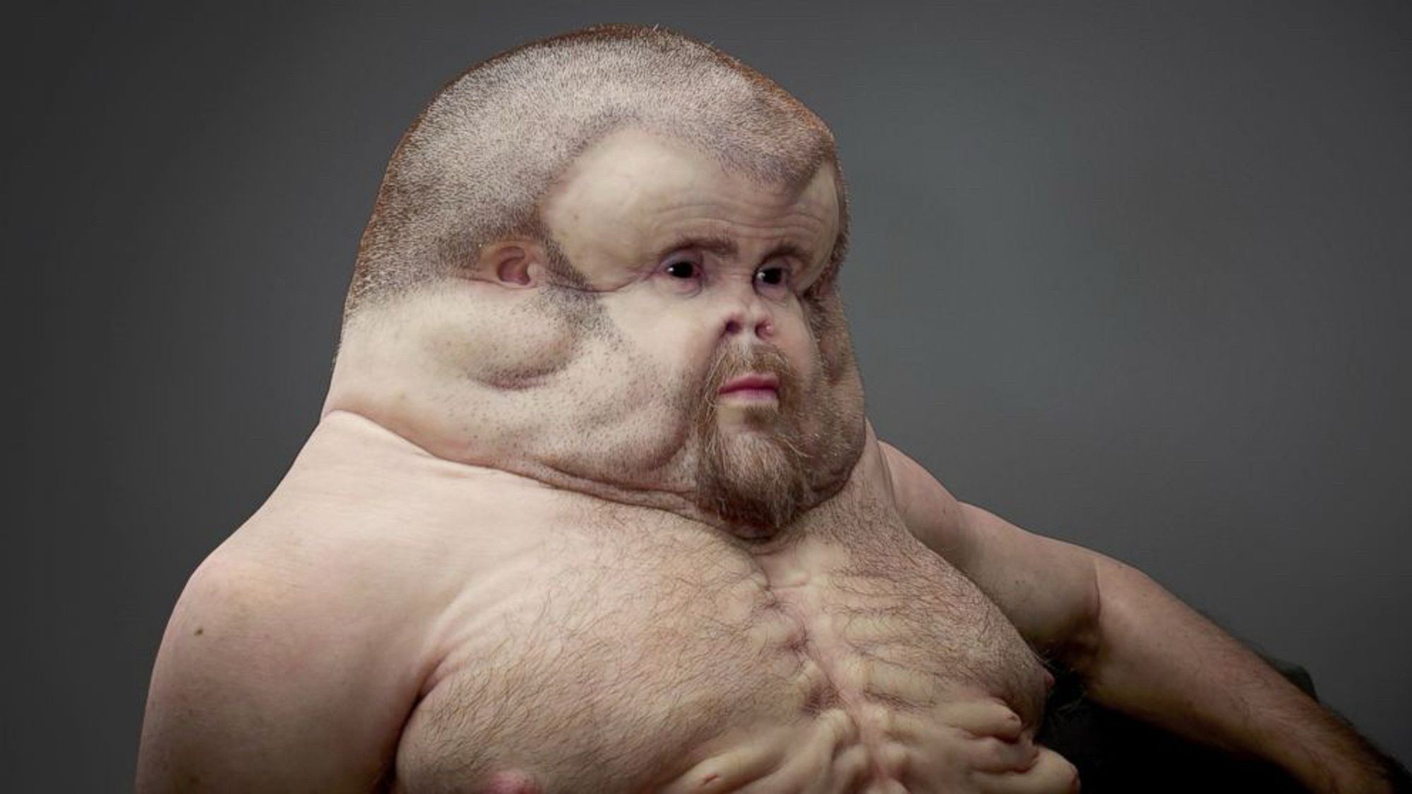 A shirtless bust of “Graham”, a hypothetical human being designed in a way to survive catastrophic car crashes. The head is large and prominent, face sunken in, and there is a very broad and prominent rib structure on the chest.