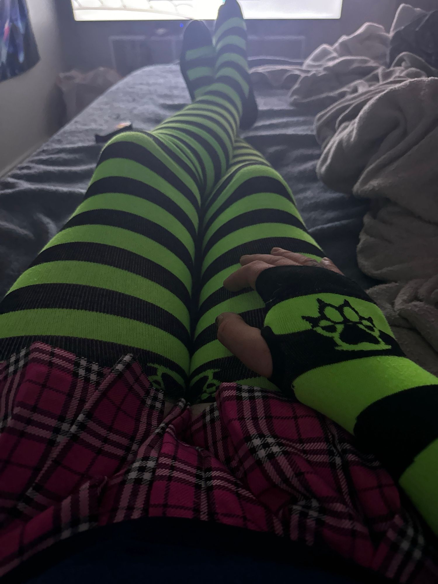 I’m wearing green and black striped thigh high socks and arm warmers with a short pink skirt.