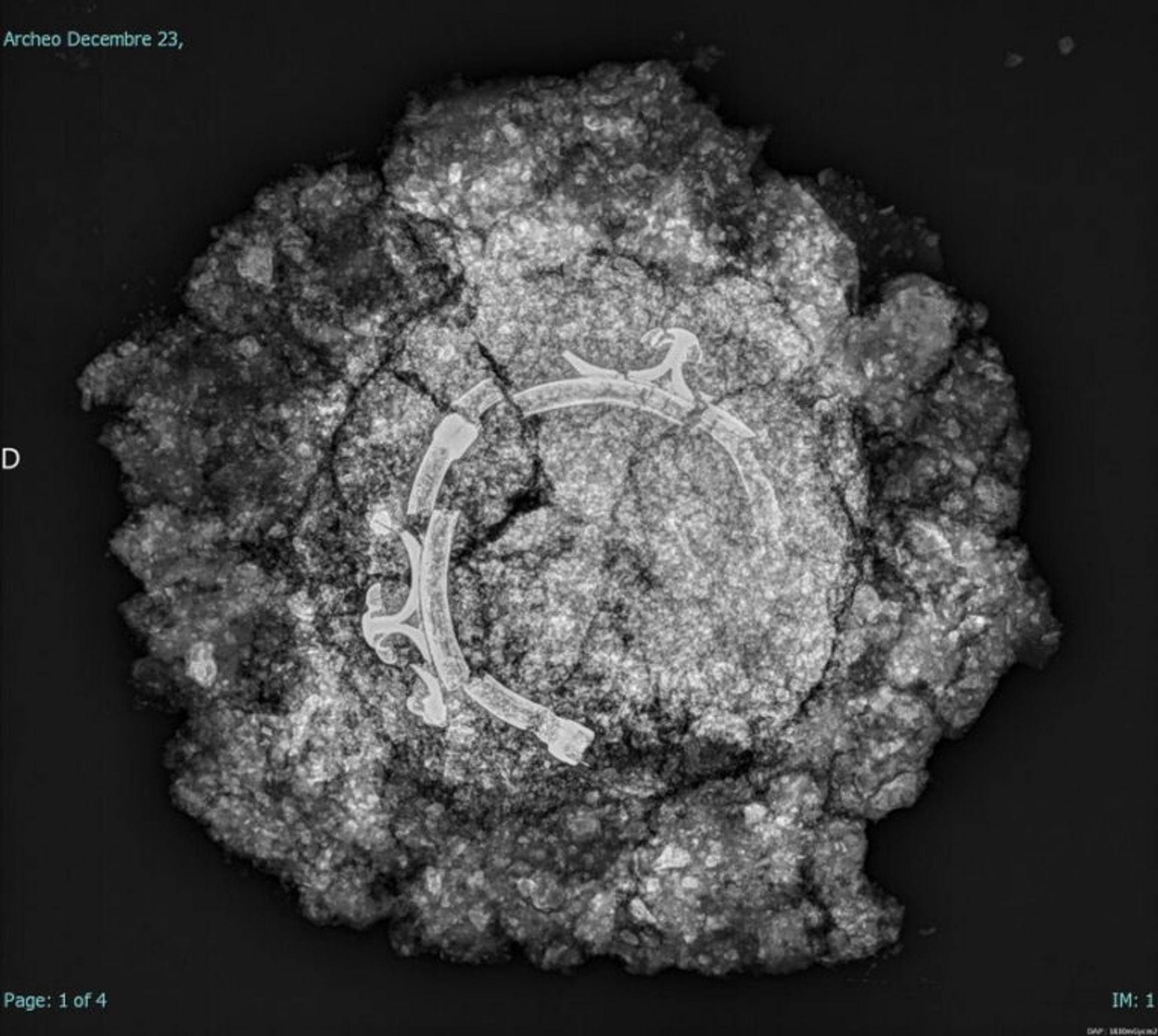 Radiographie du torque en alliage cuivreux laténien. Crédit : Charlotte Rerolle, 2024