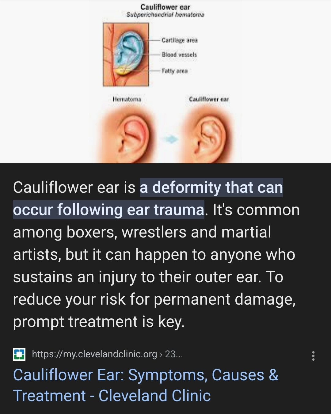 Clevelandclinic.or entry on Cauliflower Ears:

Cauliflower ear is a deformity that can occur following ear trauma. It's common among boxers, wrestlers and martial artists, but it can happen to anyone who sustains an injury to their outer ear. To reduce your risk for permanent damage, prompt treatment is key.