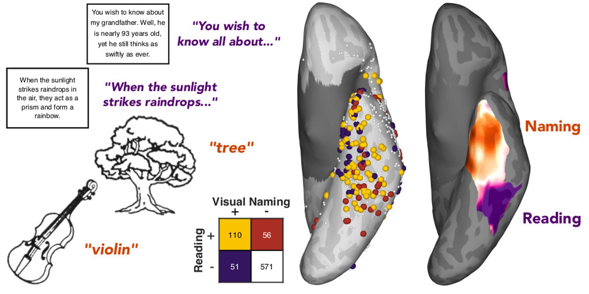 A diagram of the ventral surface of the brain, demonstrating distinct regions relating to reading or naming function.