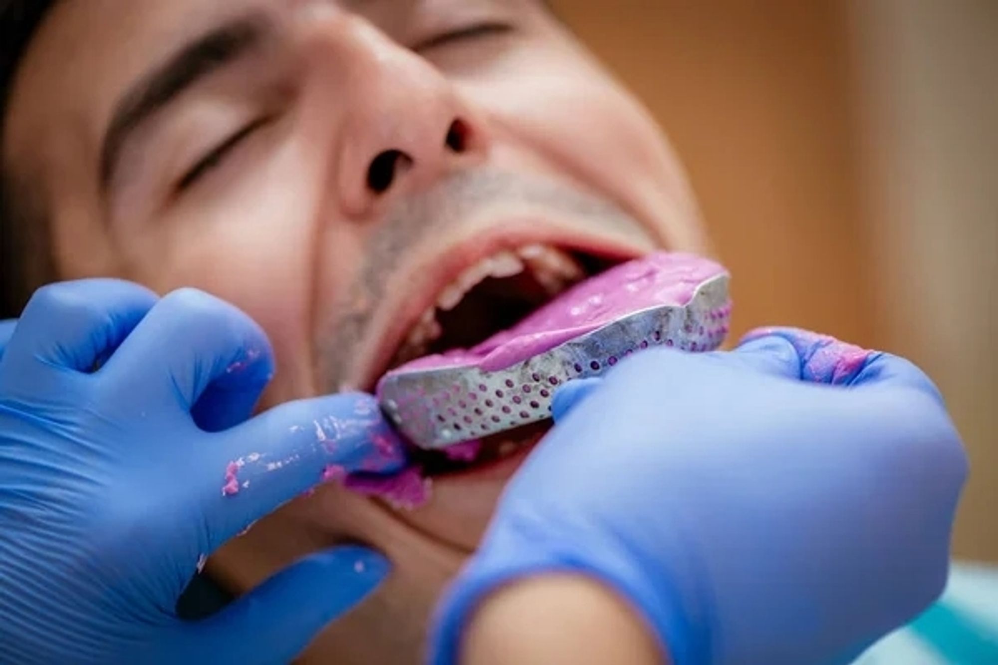 Foto de homem sendo submetido a tortura com moldagem dentaria com alginato