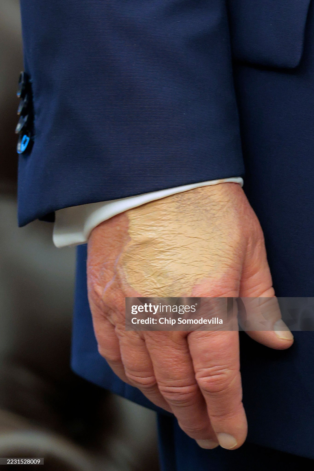 Image from Getty showing Trump's hand with makeup that is much lighter than his skin tone