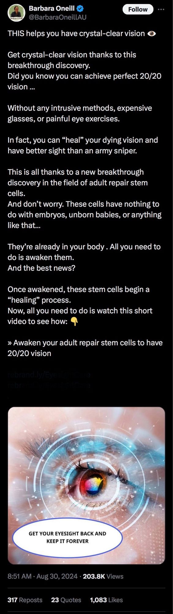 Barbara Oneill
@BarbaraOneillAU

THIS helps you have crystal-clear vision 
Get crystal-clear vision thanks to this breakthrough discovery.
Did you know you can achieve perfect 20/20 vision ...
Without any intrusive methods, expensive glasses, or painful eye exercises.
In fact, you can "heal" your dying vision and have better sight than an army sniper.
This is all thanks to a new breakthrough discovery in the field of adult repair stem cells.
And don't worry. These cells have nothing to do with embryos, unborn babies, or anything like that..
They're already in your body. All you need to do is awaken them.
And the best news?
Once awakened, these stem cells begin a
"healing" process.
Now, all you need to do is watch this short video to see how:
Awaken your adult repair stem cells to have 20/20 vision

8:51 AM • Aug 30, 2024 • 203.8K Views
317 Reposts
23 Quotes
1,083 Likes