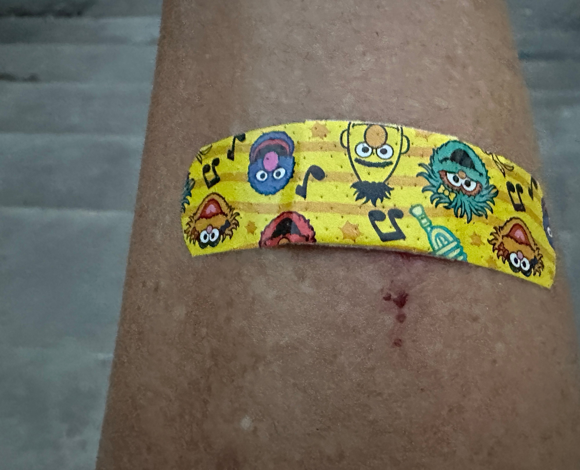 A Sesame Street bandaid on a scabby mosquito bite on a shin