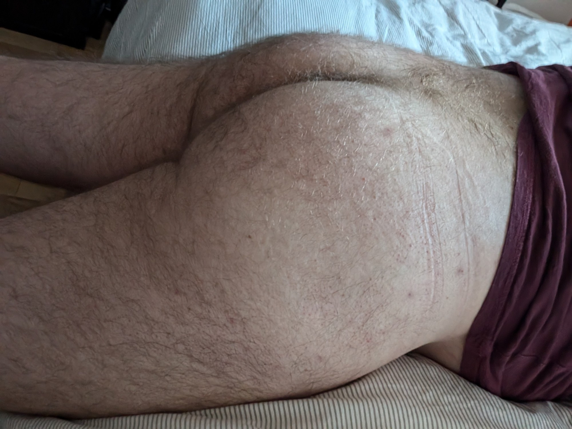 A plump and hairy butt.