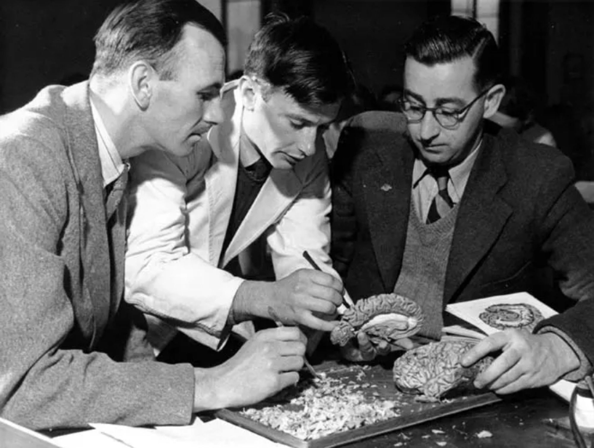 Three men (none with gloves!) dissect a brain. Black and white photo.