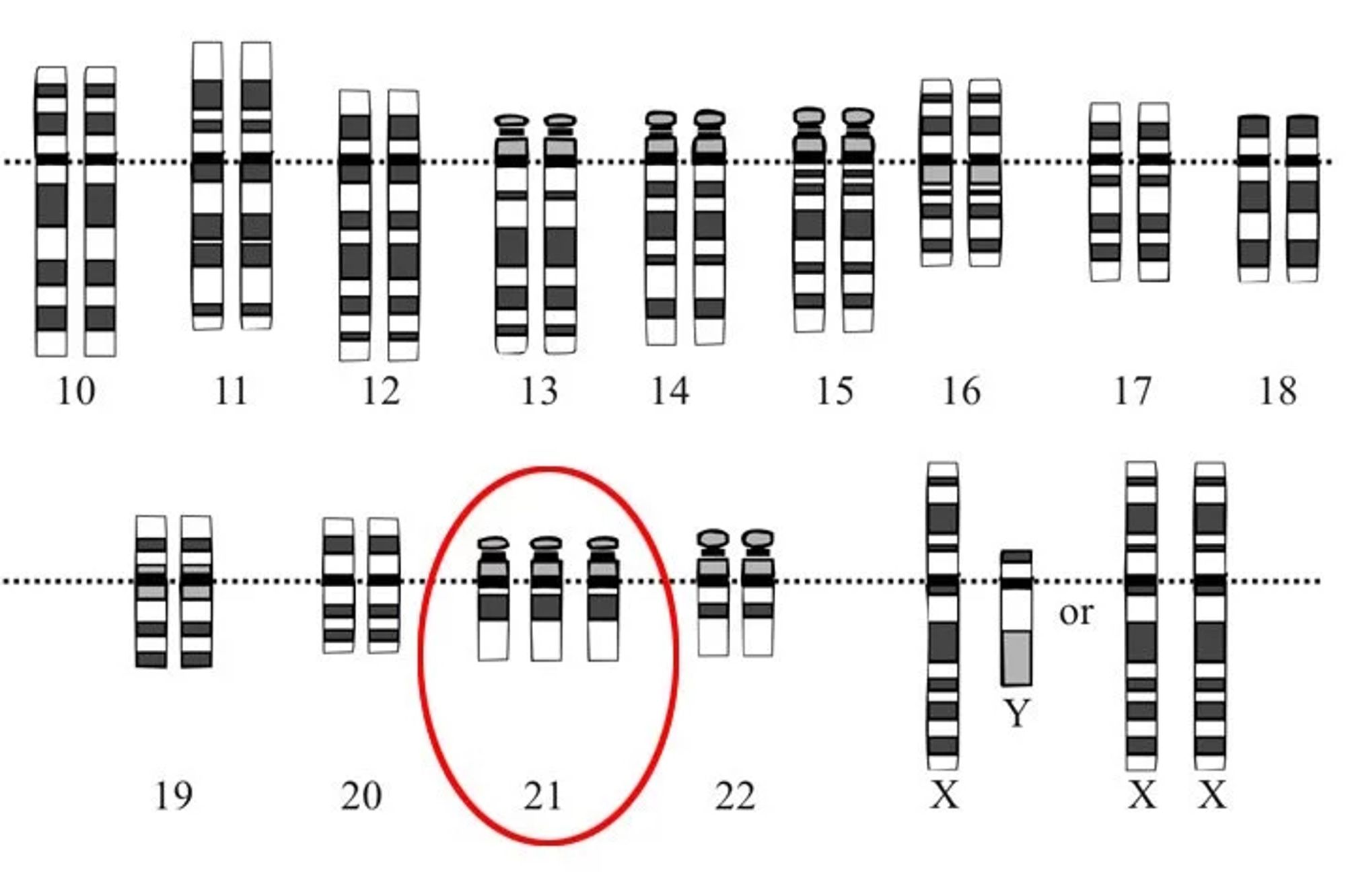 Schaubild der Chromosomenpaare von 10-22. Die 21 ist 3x vorhanden - rot markiert. 