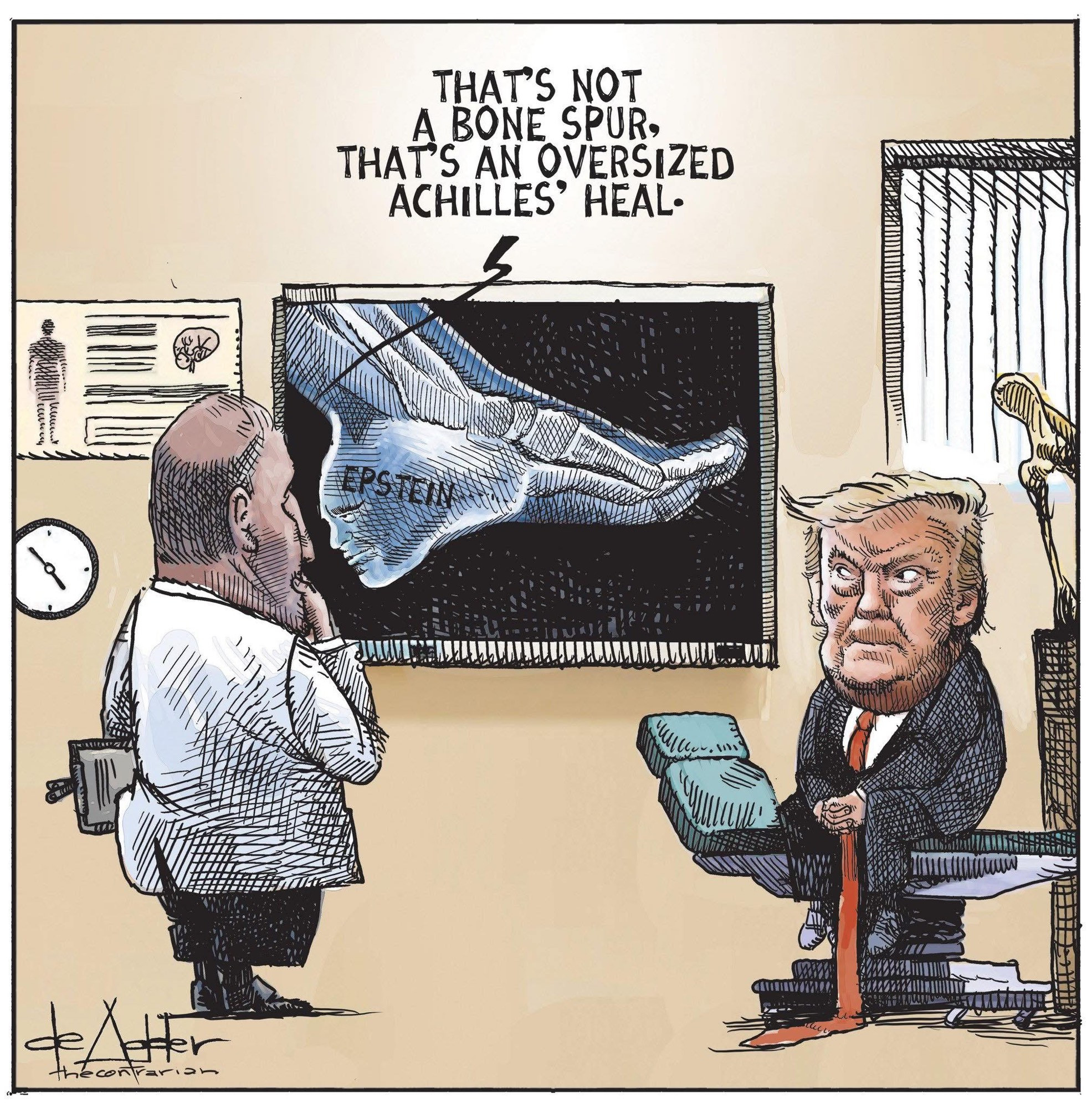 Cartoon-X-ray of Trump’s foot.  The heel is labeled “Epstein”
Podiatrist-that’s not a bone spur.  That’s an oversized Achilles’ heel. 