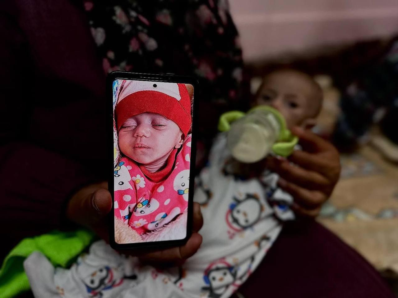 Suwar ashour 5monthold born war suffers malnutrition emaciation due closed crossings milk shortages gaza lies nasser medical complex khan yunis weighing 25 kilograms