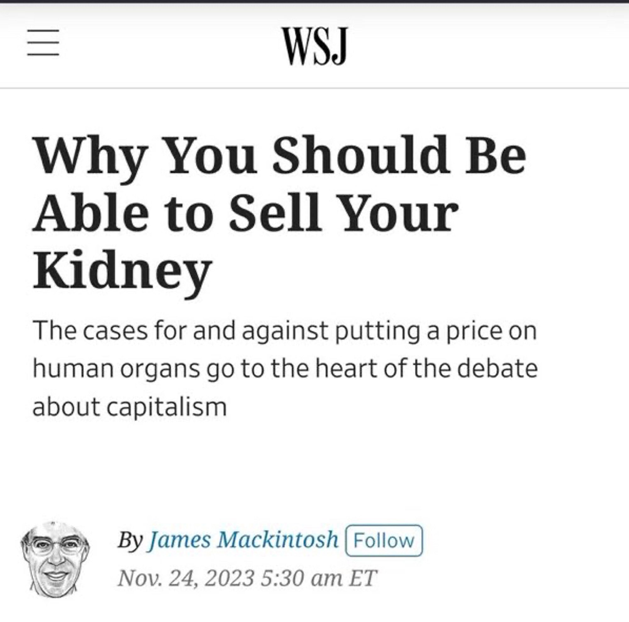 A screenshot of a Wall Street Journal article titled ‘Why You Should Be Able To Sell Your Kidney’.