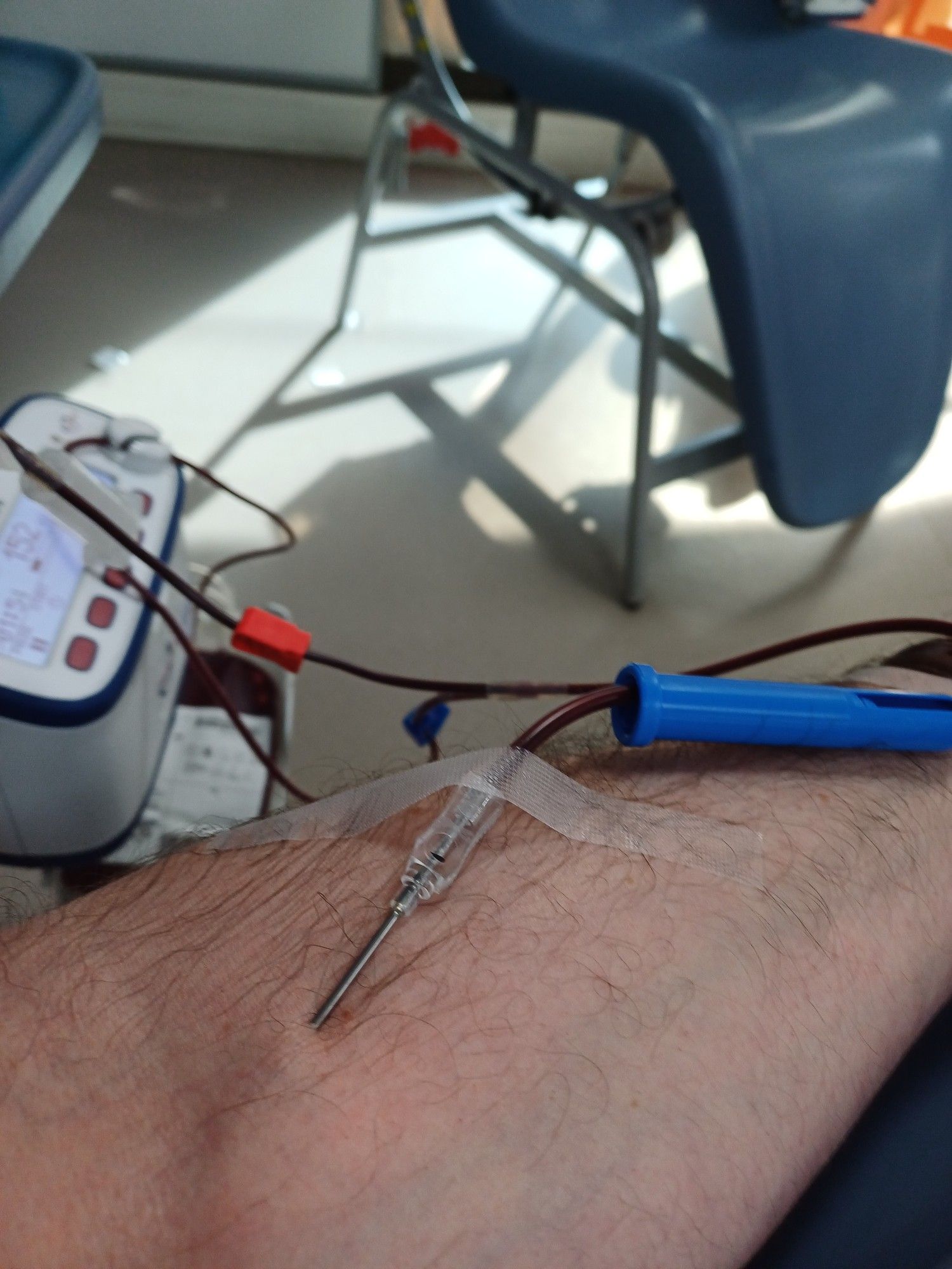 Blood donation in progress. My left arm with a large bore needle in place in the crook of my elbow. The donation bag is visible in the background