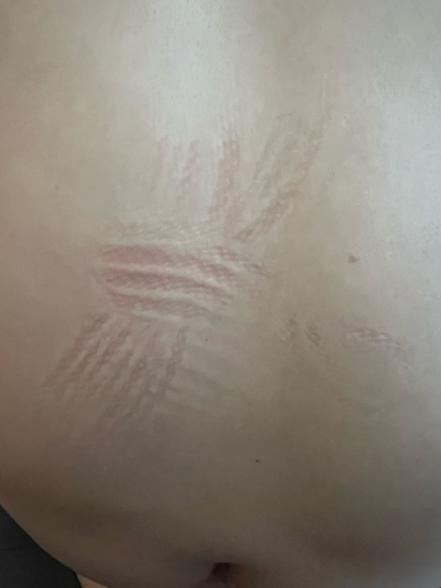 Marks from laying on the rope