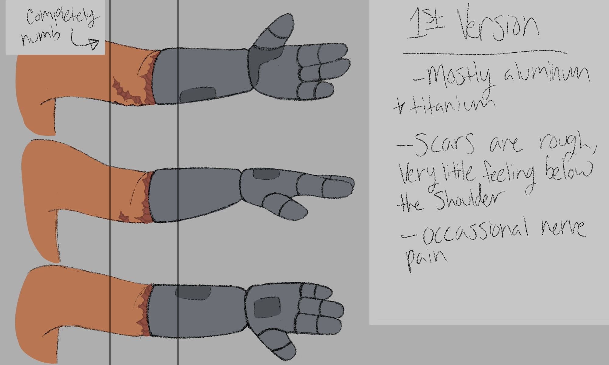 Image ID: A reference sheet for the first version of Cassie's robotic left arm in the artist's Friend Betrayed AU. The sheet shows three views of the arm from the shoulder down: palm forward, palm down, and palm backwards. The prosthetic starts right below her elbow, there is a rough scar that runs circular around the arm. The prosthetic is a typical grey metal color with a few darker grey panels. There are two lines running down the page that indicate the area on her arm that is completely numb. The text on the right reads as follows: 
1st version
- mostly aluminum & titanium
- scars are rough, very little feeling below the shoulder
- occasional nerve pain
End ID.